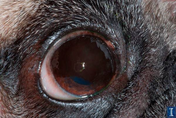 komfortos binokuláris látás hiánya javított látásműtét